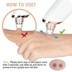 5-in-1 Electric Blackhead Remover USB Rechargeable