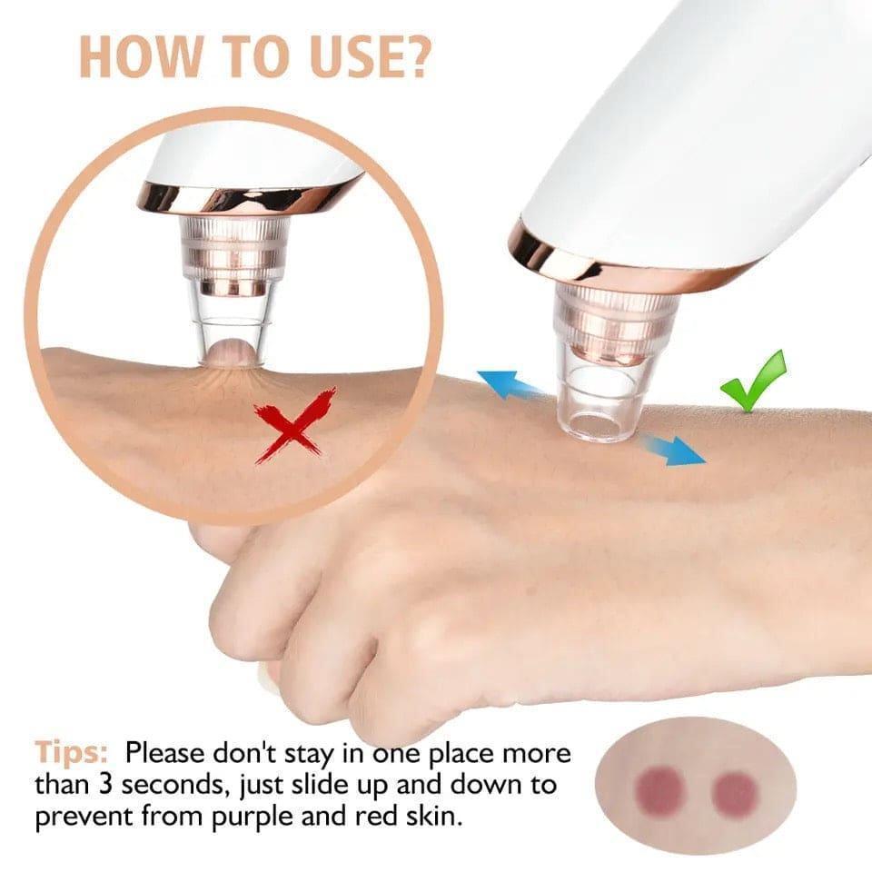 5-in-1 Electric Blackhead Remover USB Rechargeable