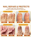 Sumifun - Bee Venom Fungal Nail Treatment Cream